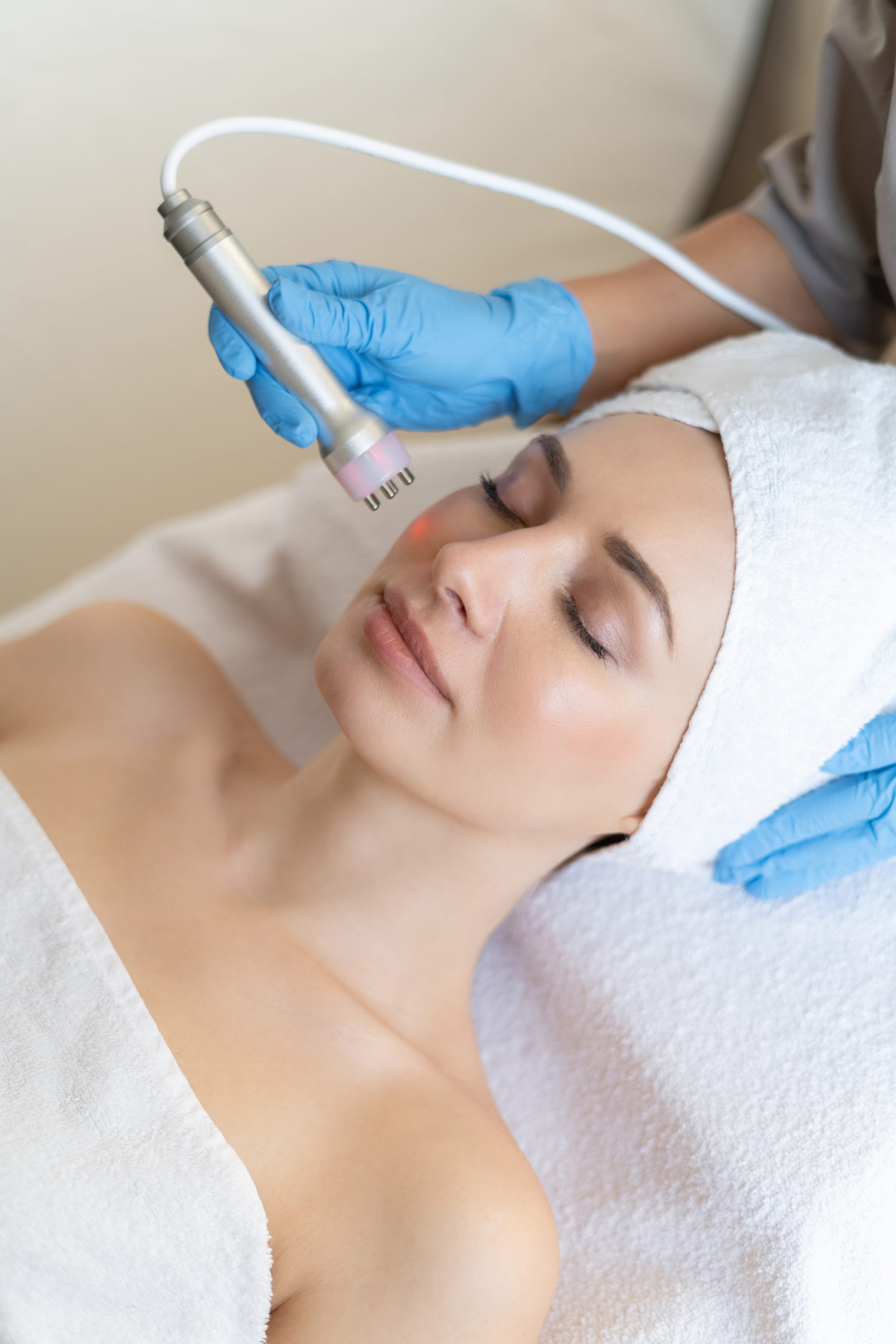 Microneedling Vaughan
