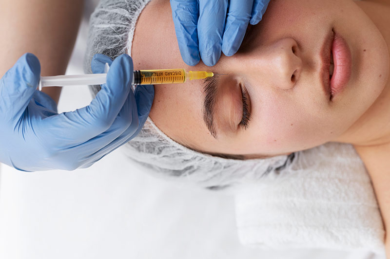 PRP FACIAL - Beauty Aesthetics