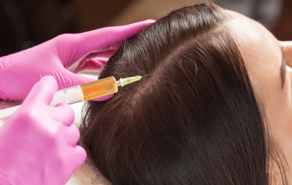 Is PRP Effective for Hair Loss?