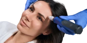 Microneedling Facial