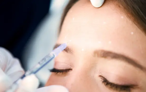 Microneedling Benefits for Skin Health