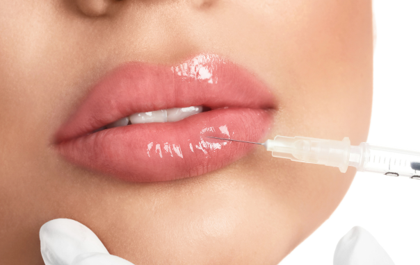 Lip Filler