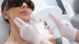 laser hair-removal