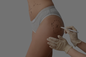 non surgical butt lift 04