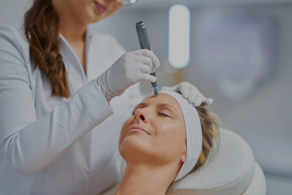 microneedling treatment 04