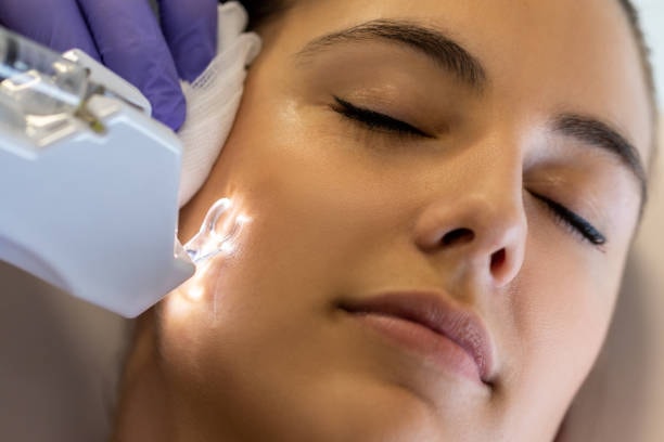 mesotherapy face