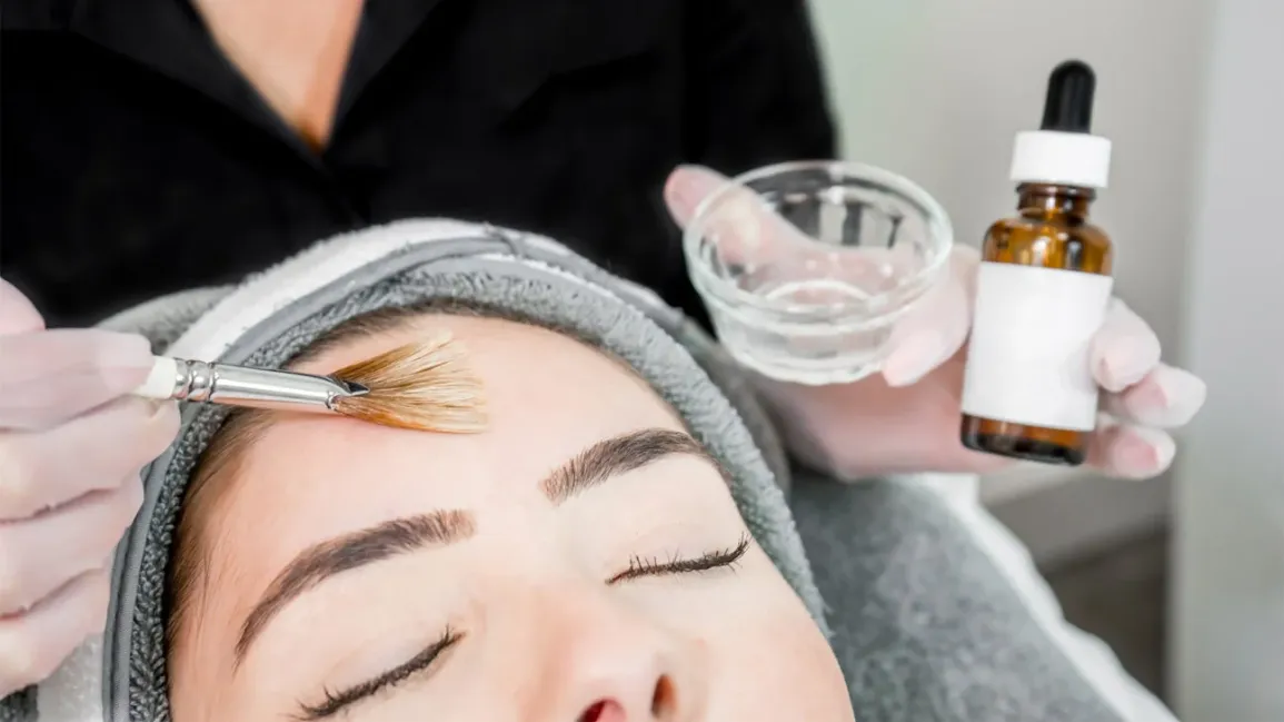 best treatment for acne scars