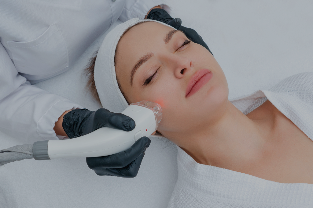 acne scar treatment