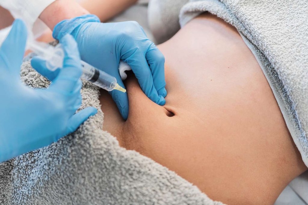 How Long Do Fat Dissolving Injection Results Last? 1 Fat dissolving injections