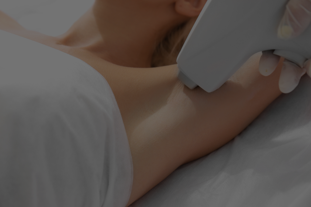 laser hair removal 03