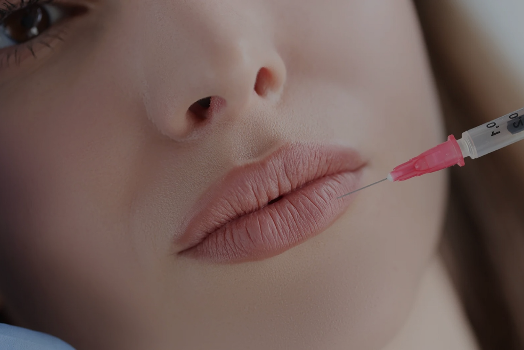 lip filler