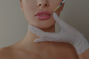 lip filler 02