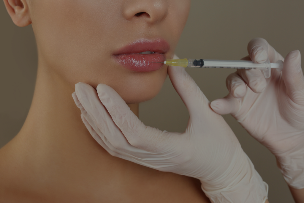 lip fillers