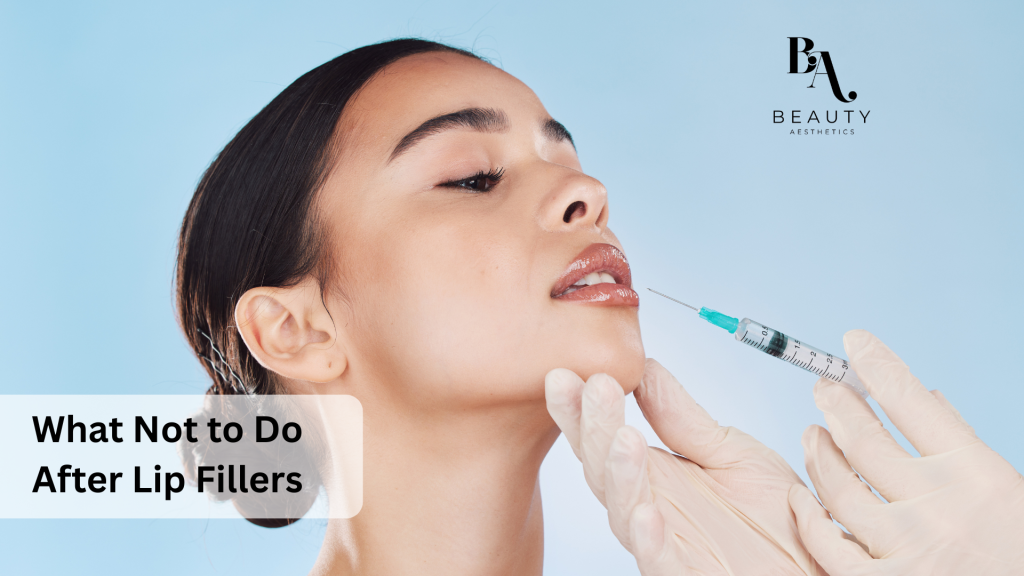 lip filler 01