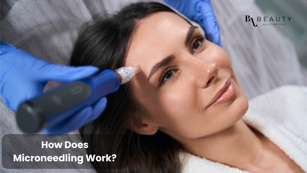 microneedling facial