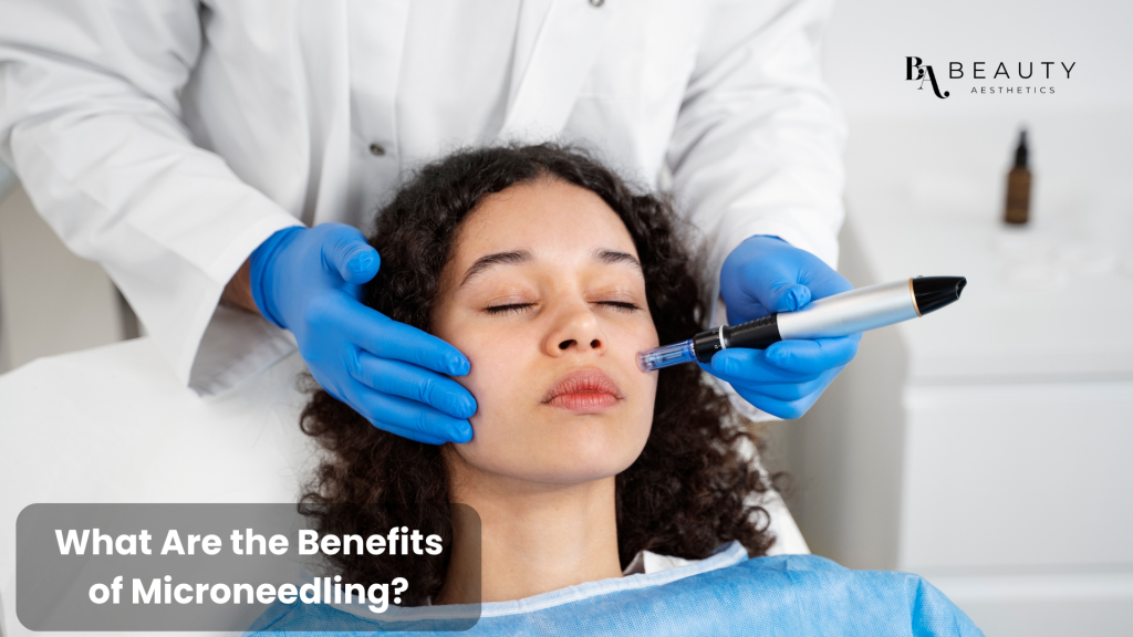 microneedling facial 03
