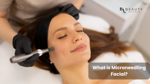 microneedling facial 02