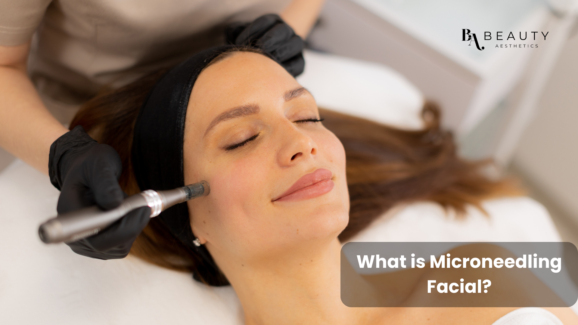 microneedling facial 02