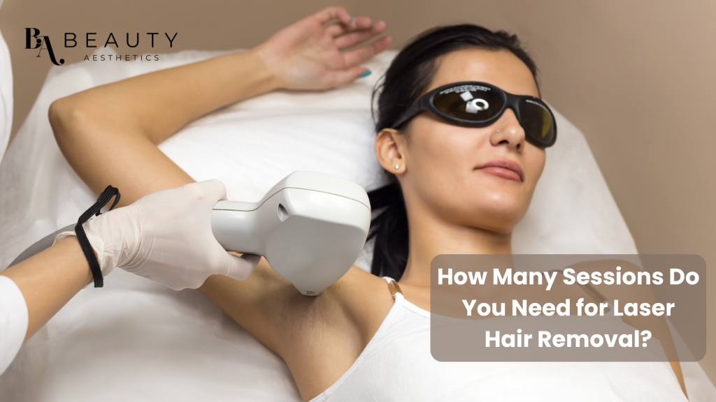 laser hair removal treatment