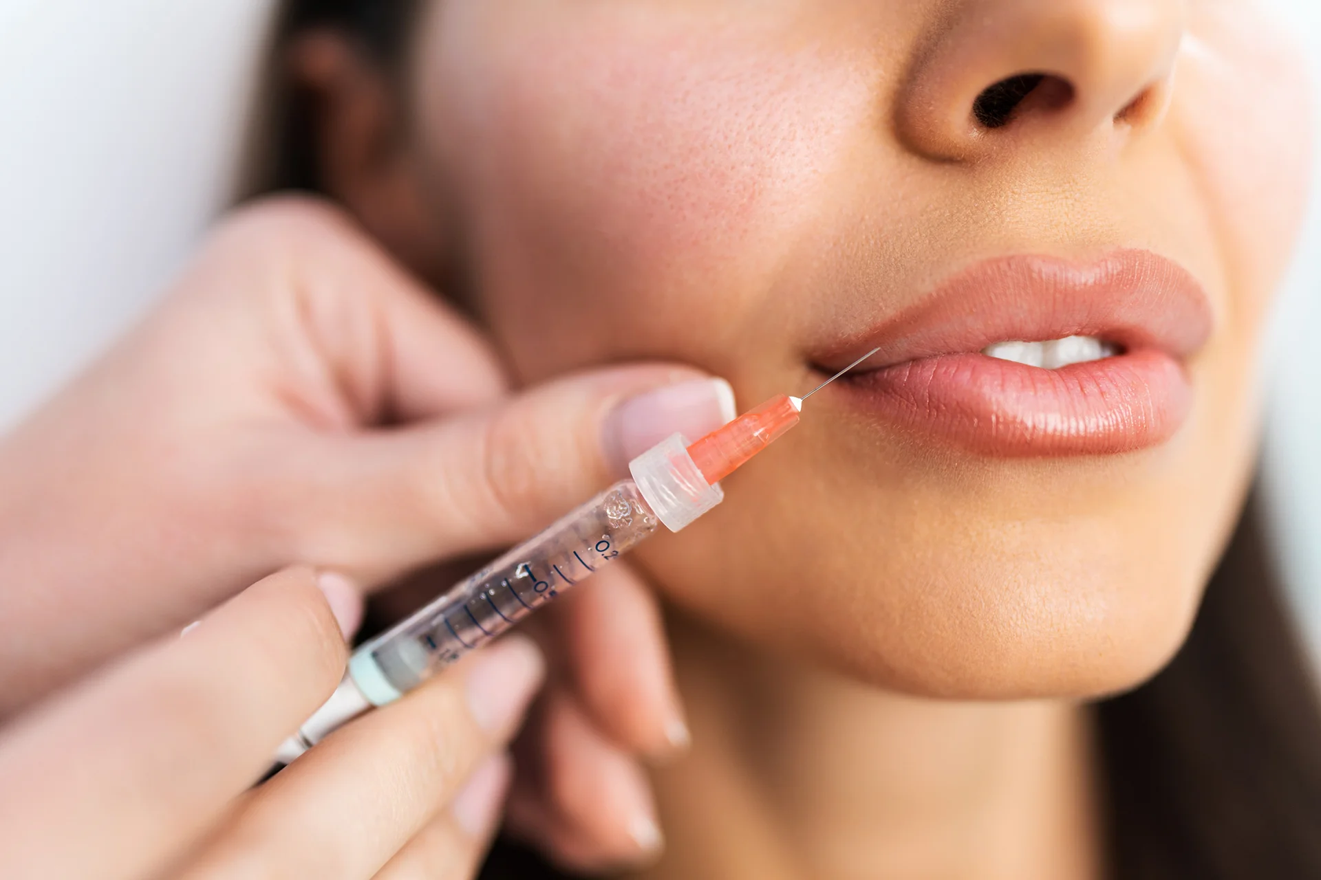 lip fillers in toronto