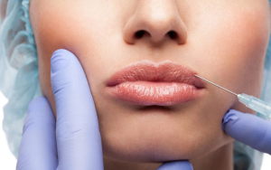 dermal fillers.