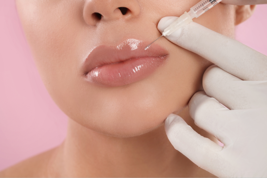 dermal filler