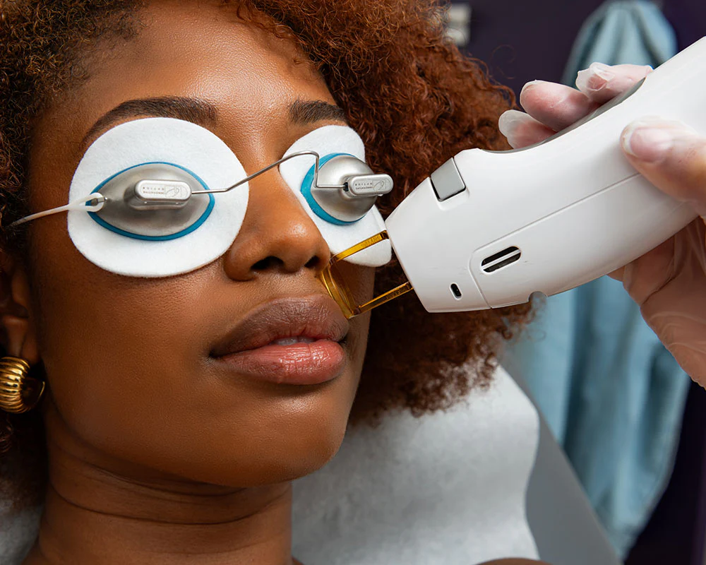 laser hair removal process