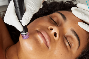 Hydrafacial 05