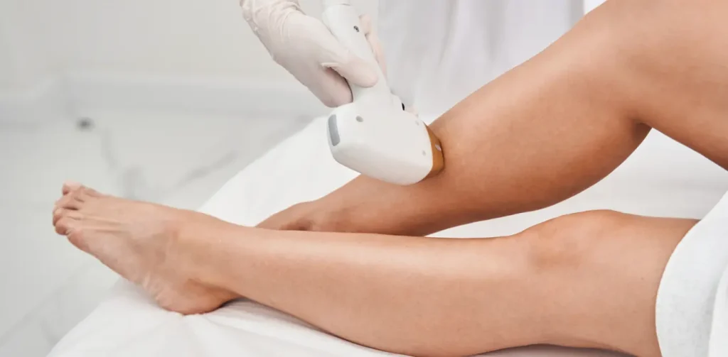 Laser Hair Removal