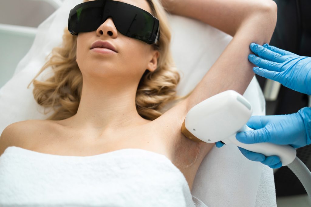 laser hair removal on dark skin