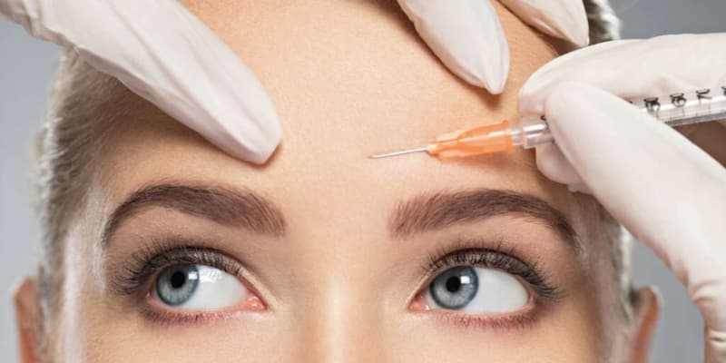 Masseter Botox 3 3 2