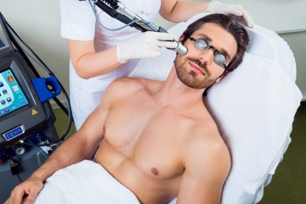 Laser Hair Removal Men