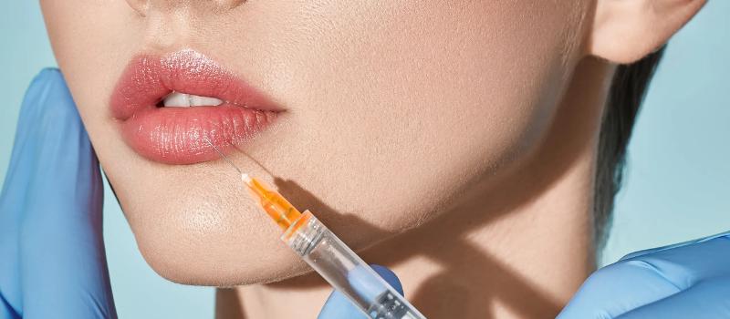 Lip Fillers Vaughan 3 hbhjbj