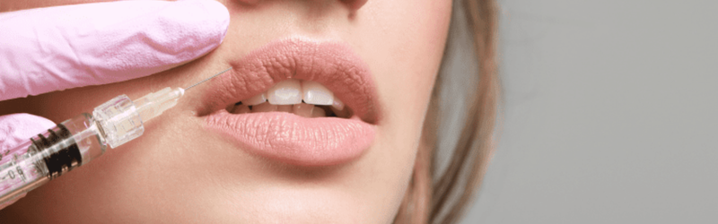 Lip Fillers Vaughan 4 jcnjcbh