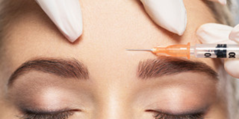 Masseter Botox 12 uhujhgjgb