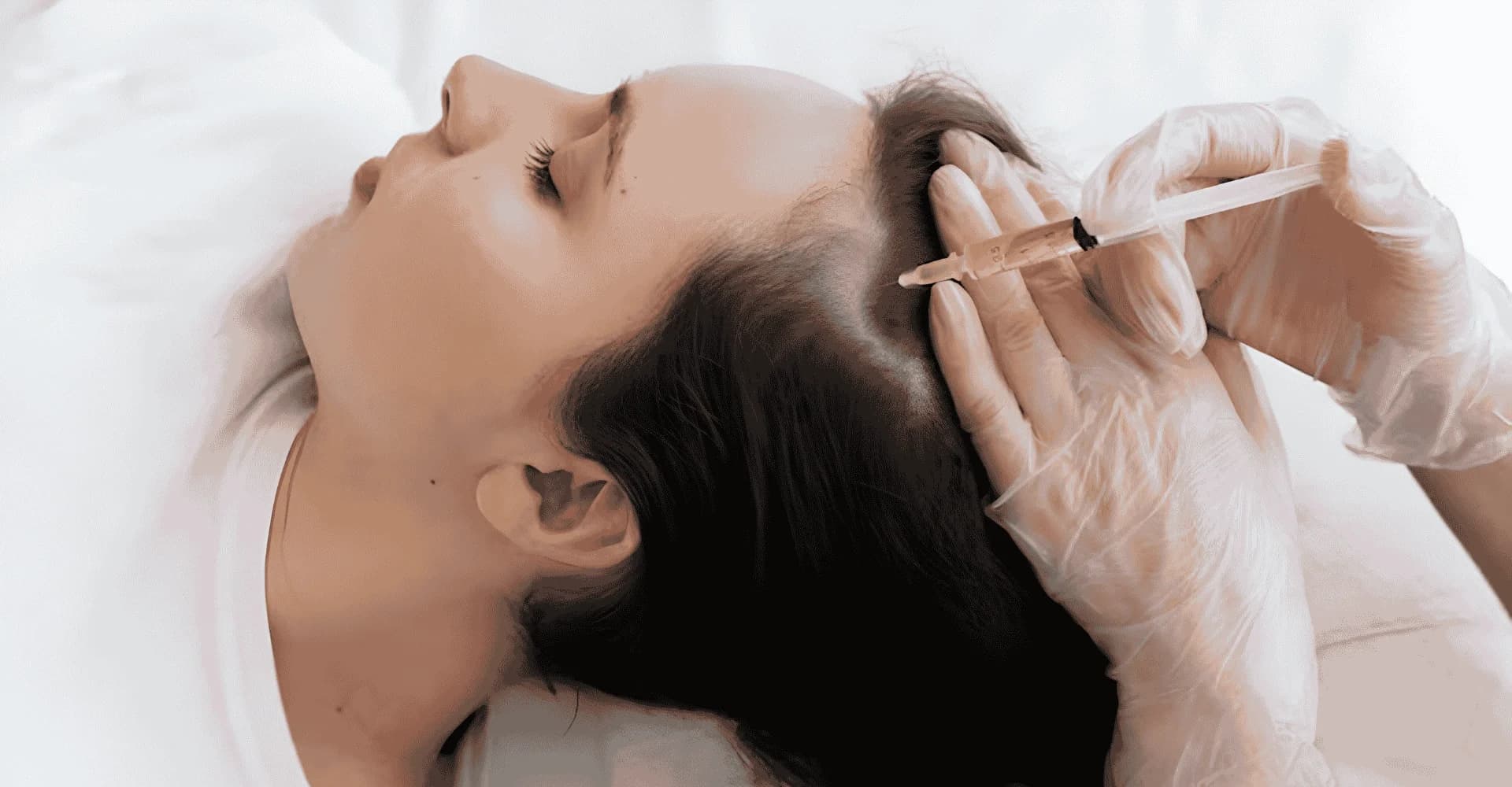 prp hair regrowth process