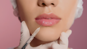lip filler treatment
