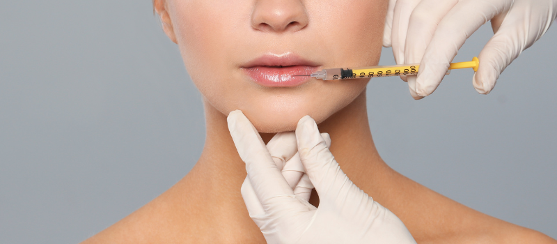 Radiesse Dermal Filler Toronto 8 cfvdscds