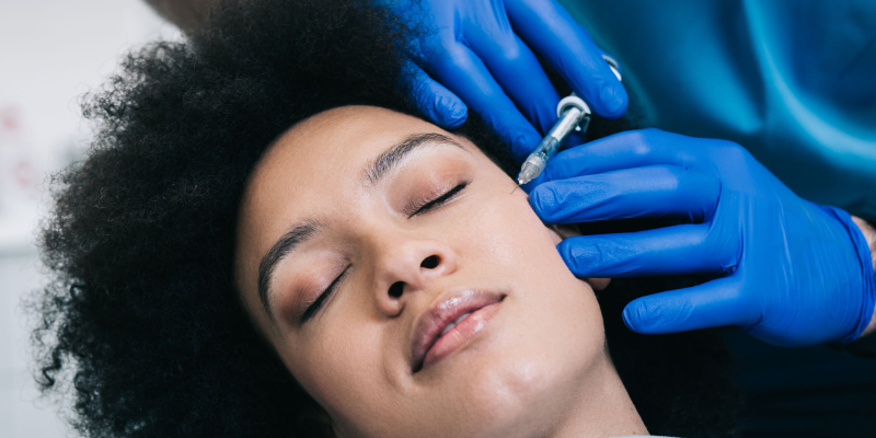 Microneedling Vaughan 4