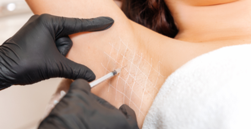 Sweat Treatments 3 ghvyhgjjhghj