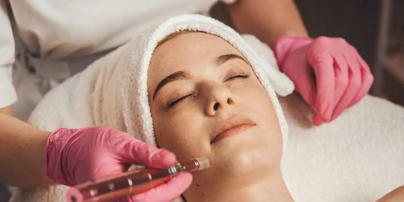 Microneedling Vaughan 6 hbhjbgjh