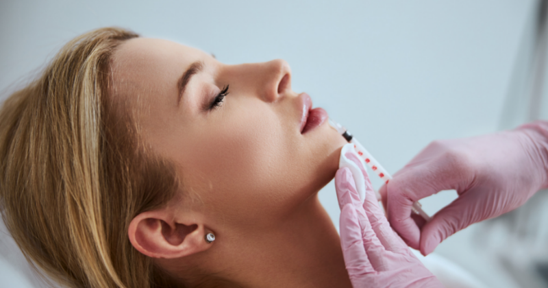 Radiesse Dermal Filler Toronto 10 hdfbhdbdj