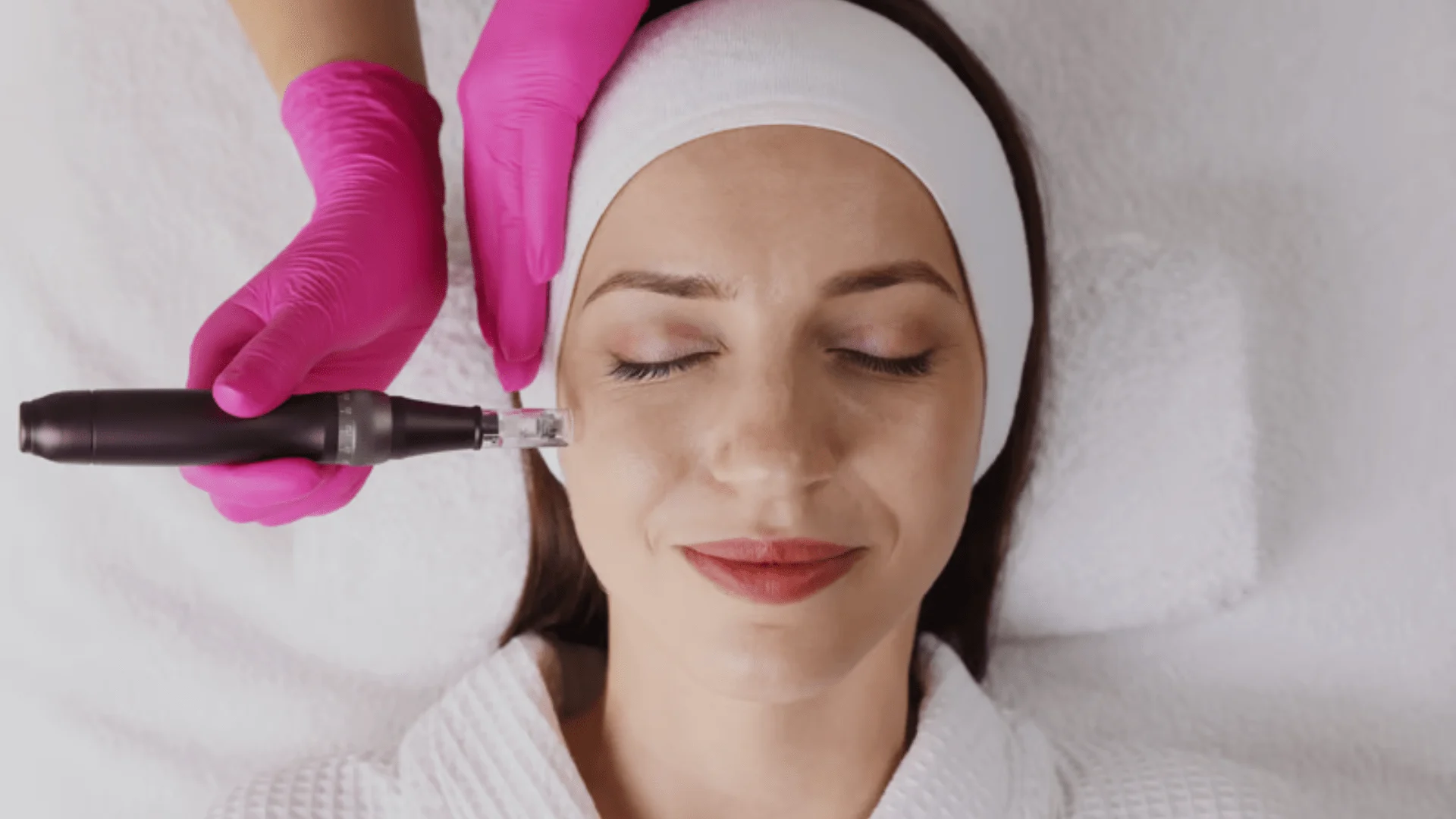 Microneedling near me