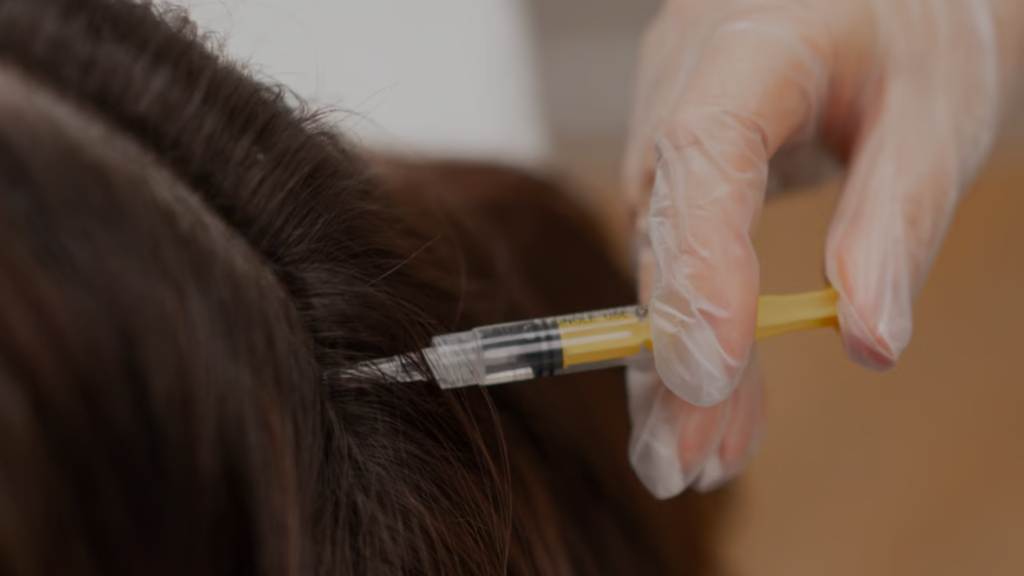 How Many PRP Sessions Are Needed for Hair Growth? 1 prp
