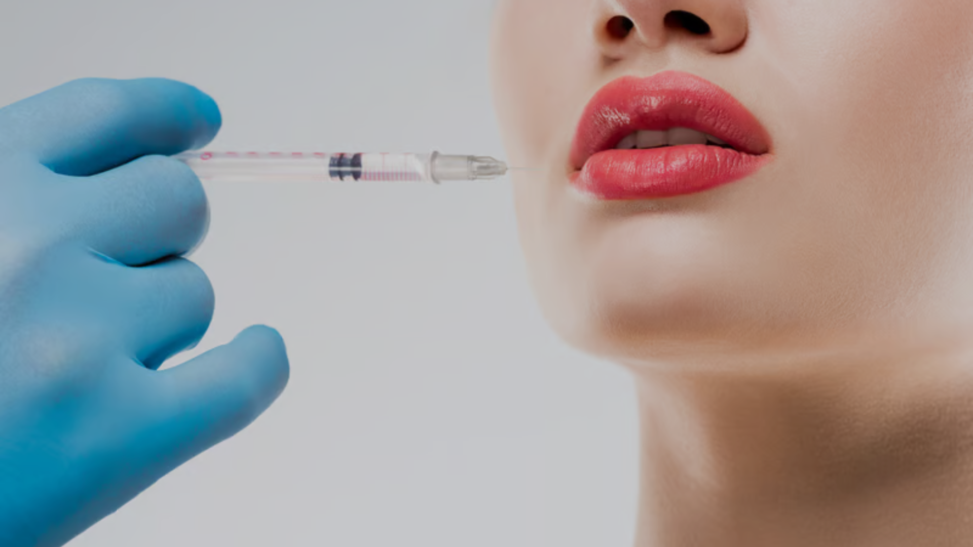 dermal filler treatment in beauty aesthetics