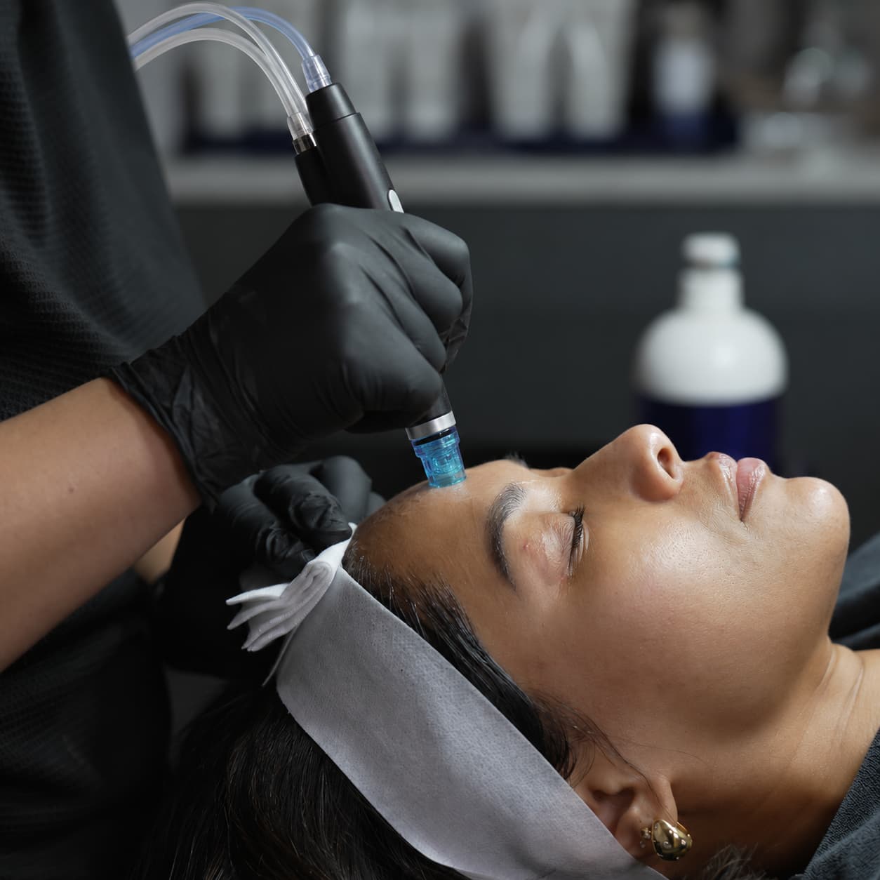 HydraFacial Skin Concerns 02 Forehead