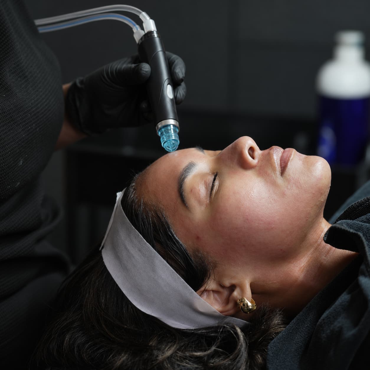 HydraFacial Skin Concerns 04 Treatment