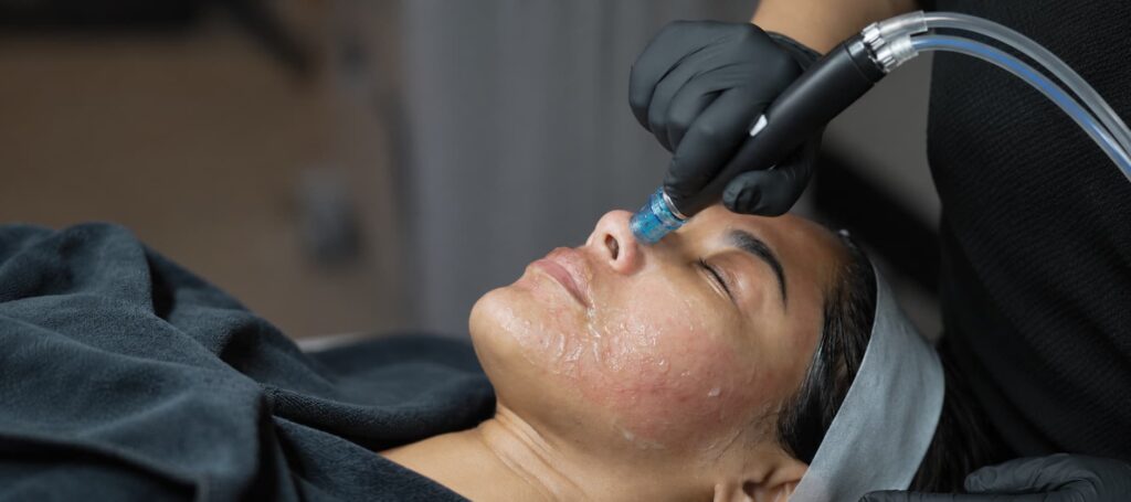 HydraFacial Step 3 Hydrate